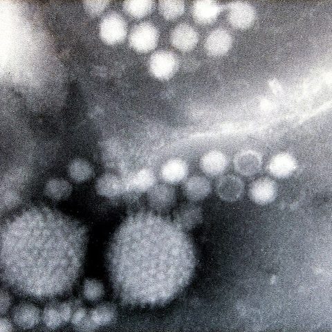 Mpox 2024 (Monkeypox clade Ib) electron micrograph