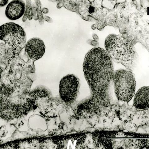 Hantaan virus electron micrograph