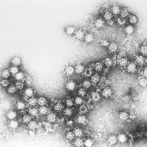 Human papillomavirus 18 electron micrograph
