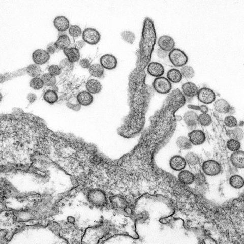 COVID Delta variant electron micrograph