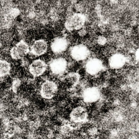 Ross River virus electron micrograph