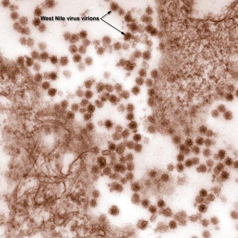 Andes virus electron micrograph