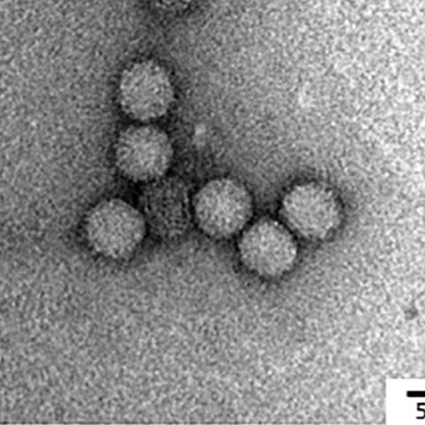 Cowpox virus electron micrograph