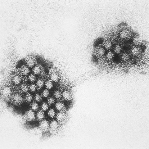 Varicella-zoster virus electron micrograph