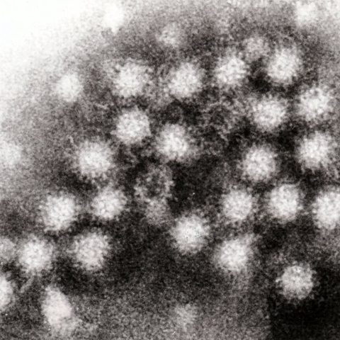 Human adenovirus 7 electron micrograph