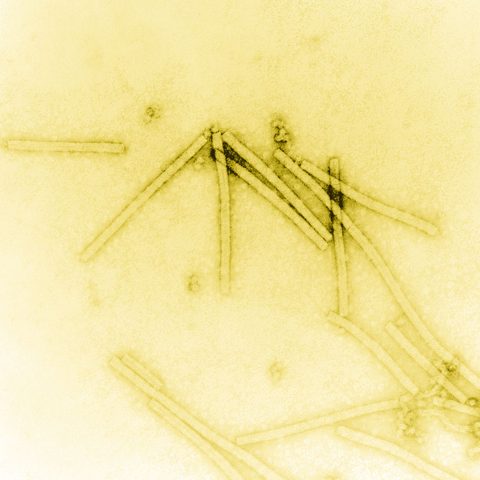 Japanese encephalitis virus electron micrograph