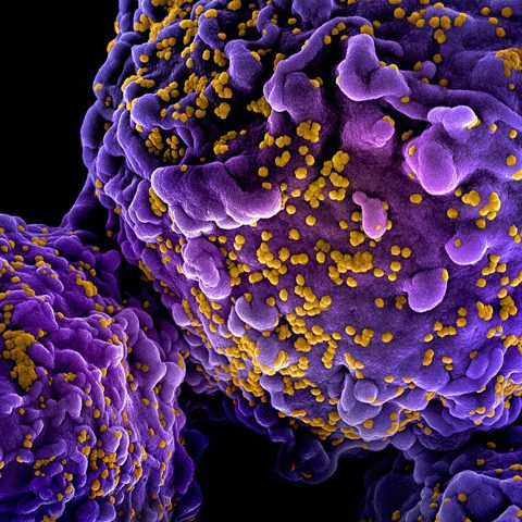 Peste des petits ruminants virus electron micrograph
