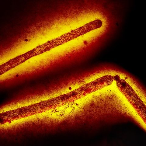SFTS virus electron micrograph
