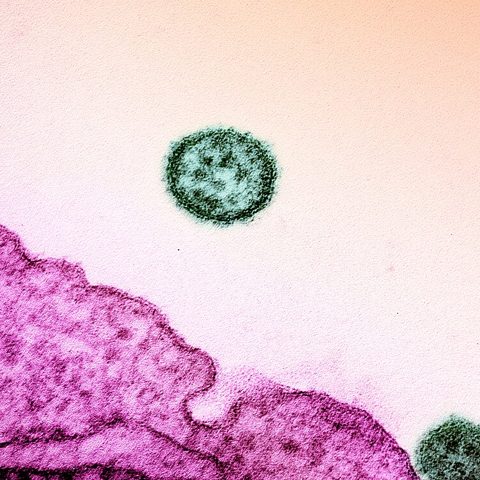 Bird Flu H7N7 electron micrograph