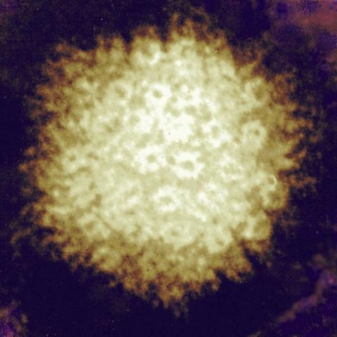 Herpes simplex virus 1 electron micrograph