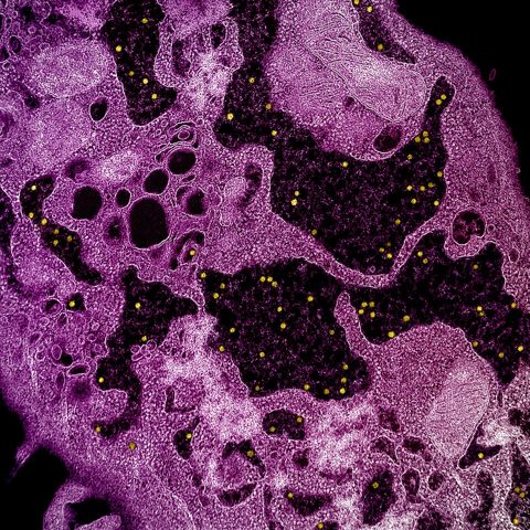 COVID Omicron variant electron micrograph