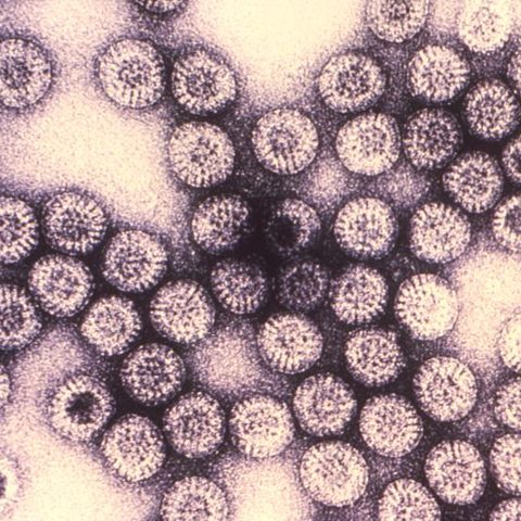 Rhinovirus C electron micrograph
