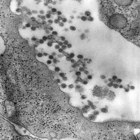 Dengue virus 3 electron micrograph