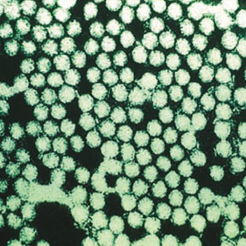 Rinderpest virus electron micrograph