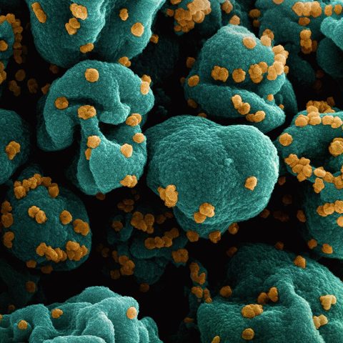 Machupo virus electron micrograph