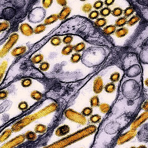 Seoul virus electron micrograph