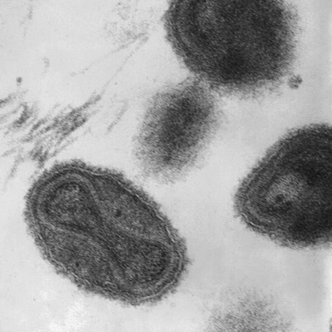 Human astrovirus electron micrograph