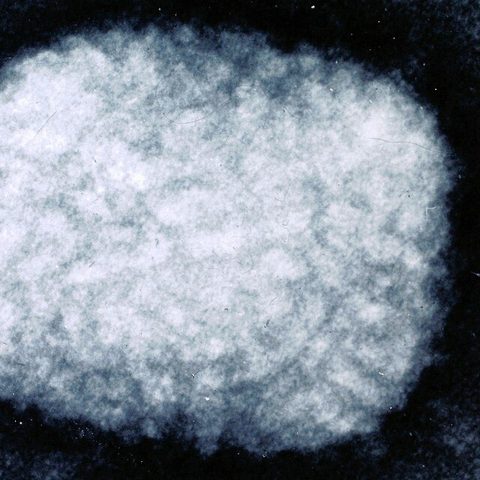 Bat coronavirus RaTG13 electron micrograph