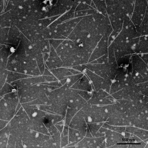 Classical swine fever virus electron micrograph