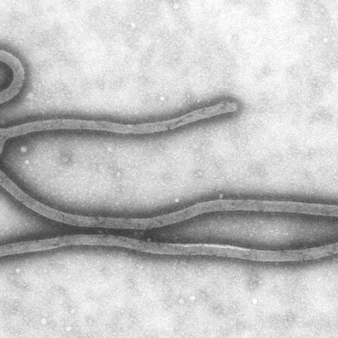 Schmallenberg virus electron micrograph