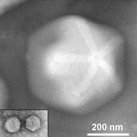 Dengue virus 4 electron micrograph