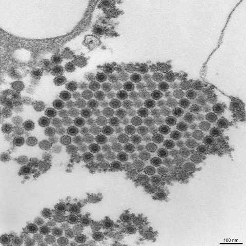 SARS 2003 (SARS-CoV) electron micrograph