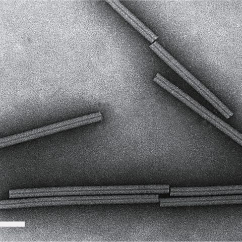 Tick-borne encephalitis virus electron micrograph