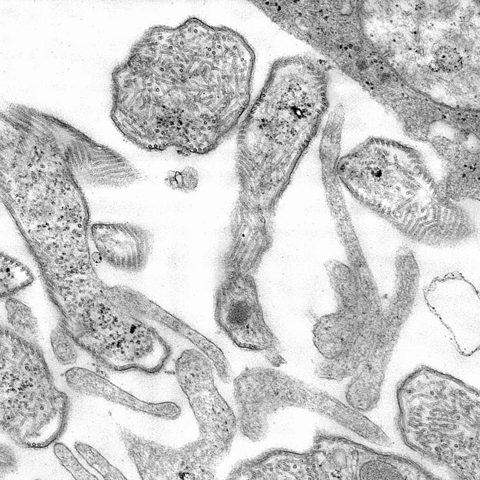 Myxoma virus electron micrograph
