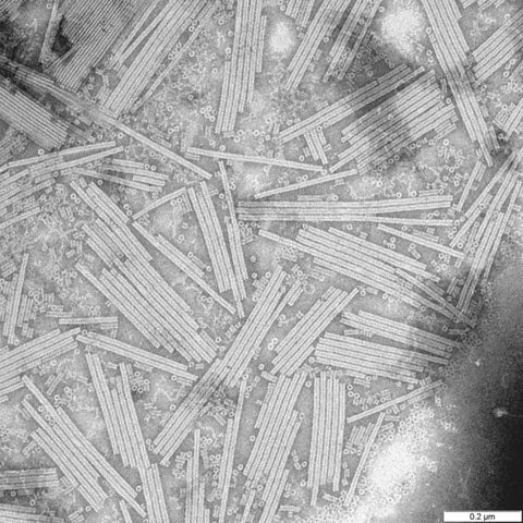 COVID Alpha variant electron micrograph