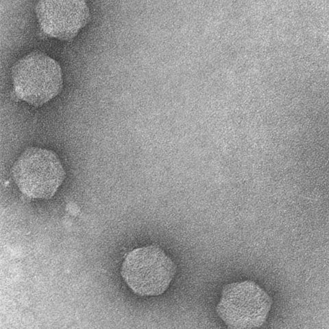 Enterovirus D68 electron micrograph