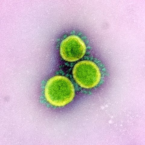 Human parainfluenza virus 3 electron micrograph