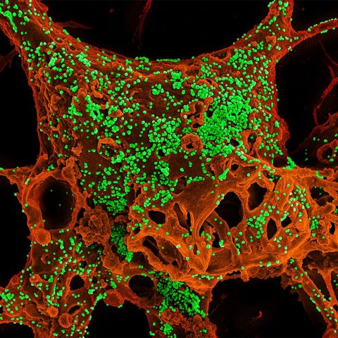 MERS 2012 (MERS-CoV) electron micrograph