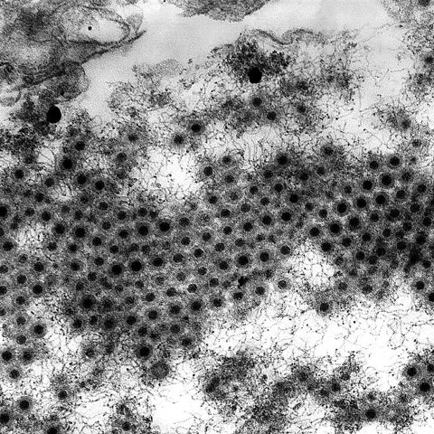 Kyasanur Forest disease virus electron micrograph
