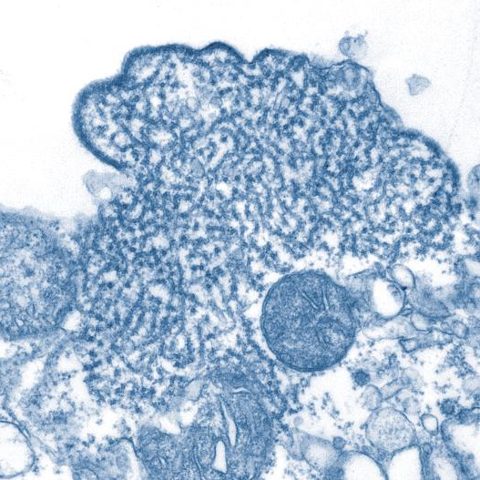 Sin Nombre virus electron micrograph