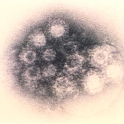 Rabbit hemorrhagic disease virus electron micrograph