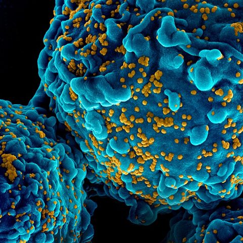 Bundibugyo virus electron micrograph