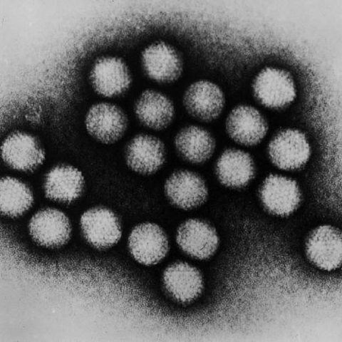 Bird Flu H5N8 electron micrograph