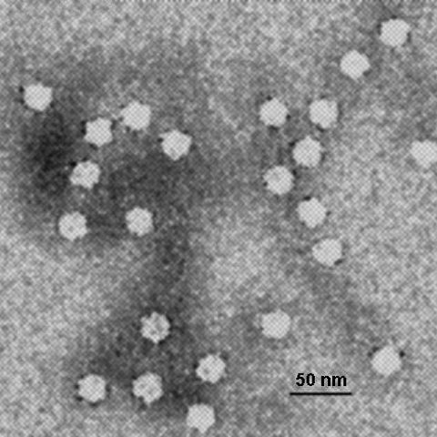 Mayaro virus electron micrograph