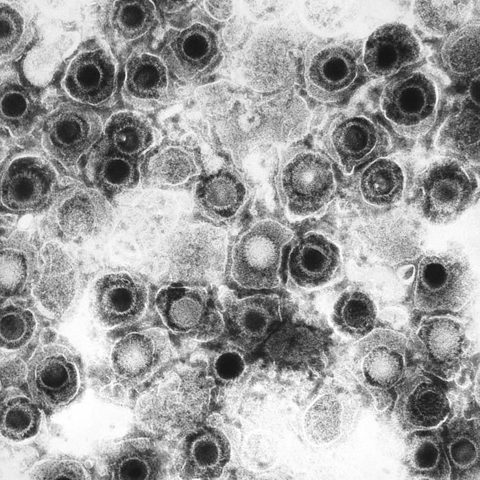Rabies virus electron micrograph
