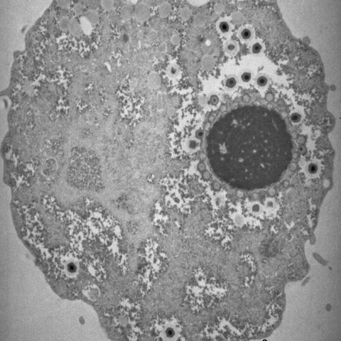 African swine fever virus electron micrograph