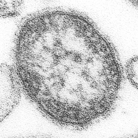 Bird Flu H5N1 electron micrograph