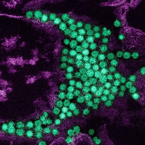 Human coronavirus NL63 electron micrograph