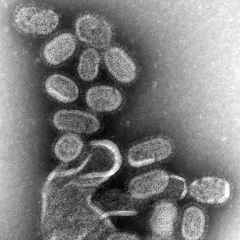 Poliovirus 3 electron micrograph