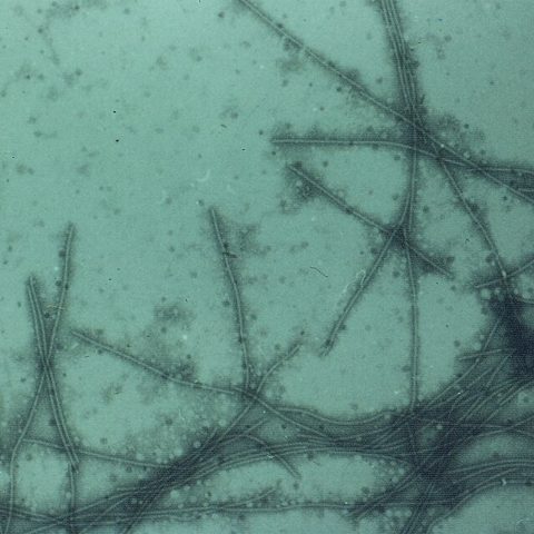 West Nile virus electron micrograph