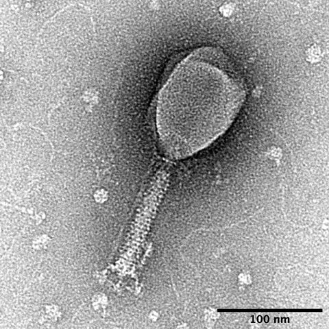 Bird Flu H5N6 electron micrograph