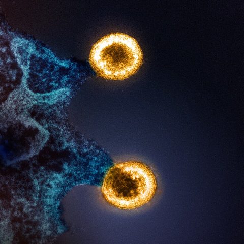 Junin virus electron micrograph