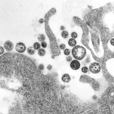Hepatitis D virus electron micrograph