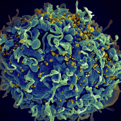Russian Flu 1977 (H1N1) electron micrograph