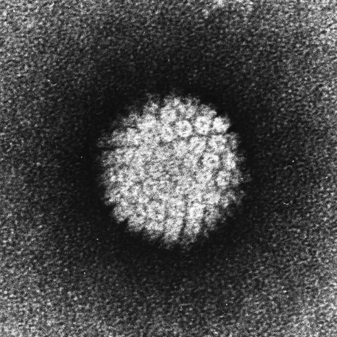 Foot-and-mouth disease virus electron micrograph