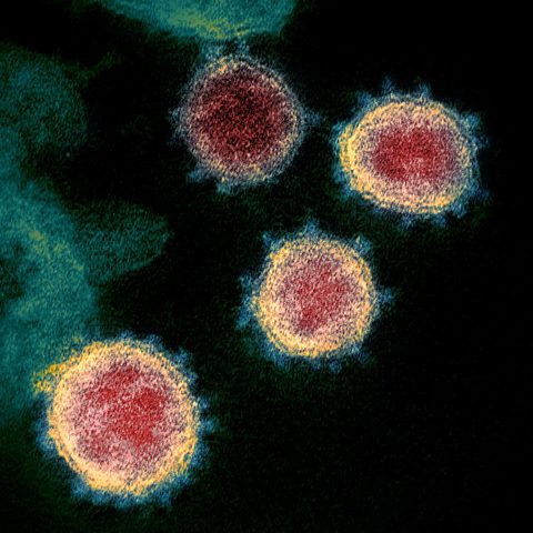 Human metapneumovirus electron micrograph
